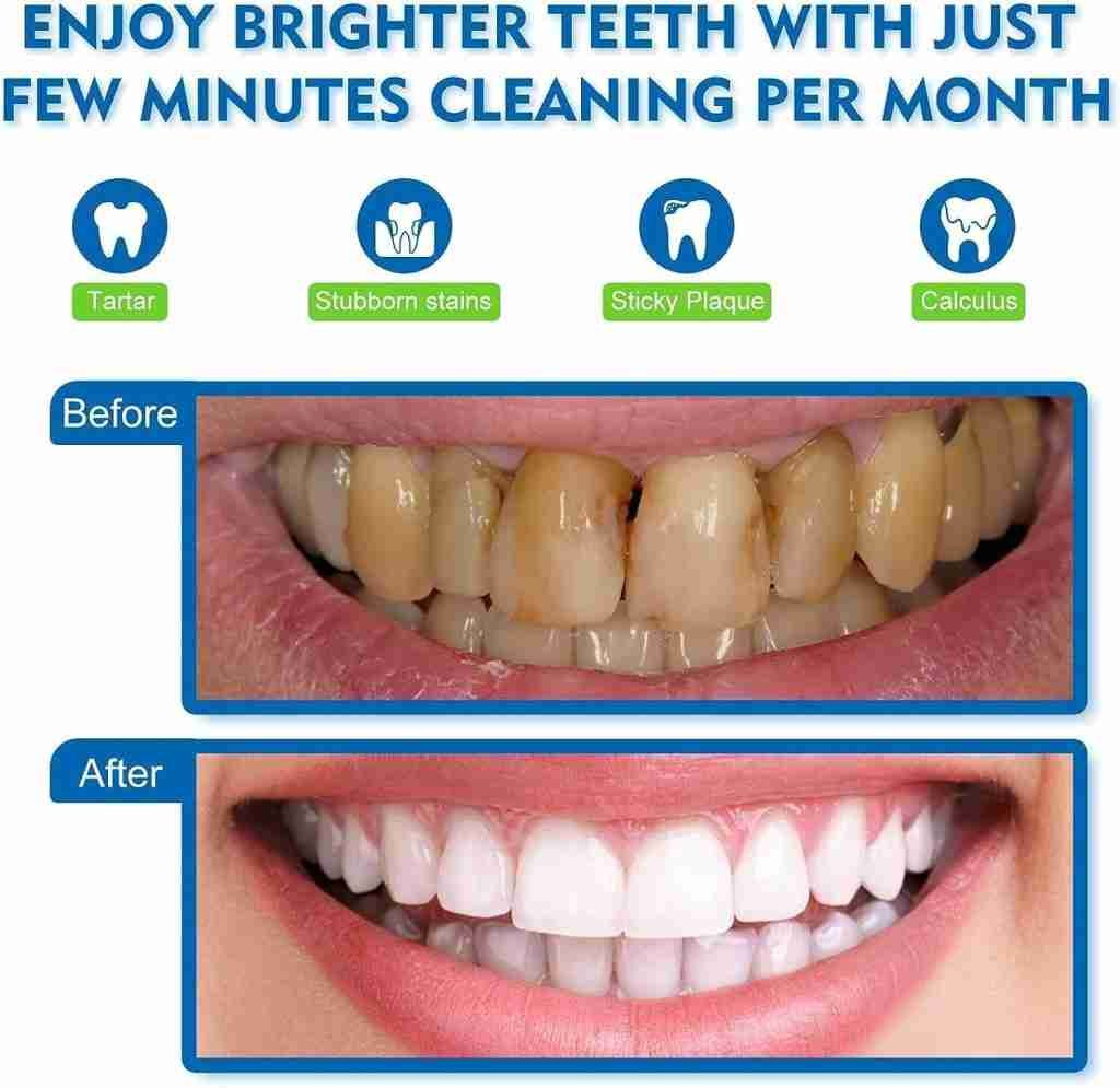 71KU+bGs4yL. AC SL1500